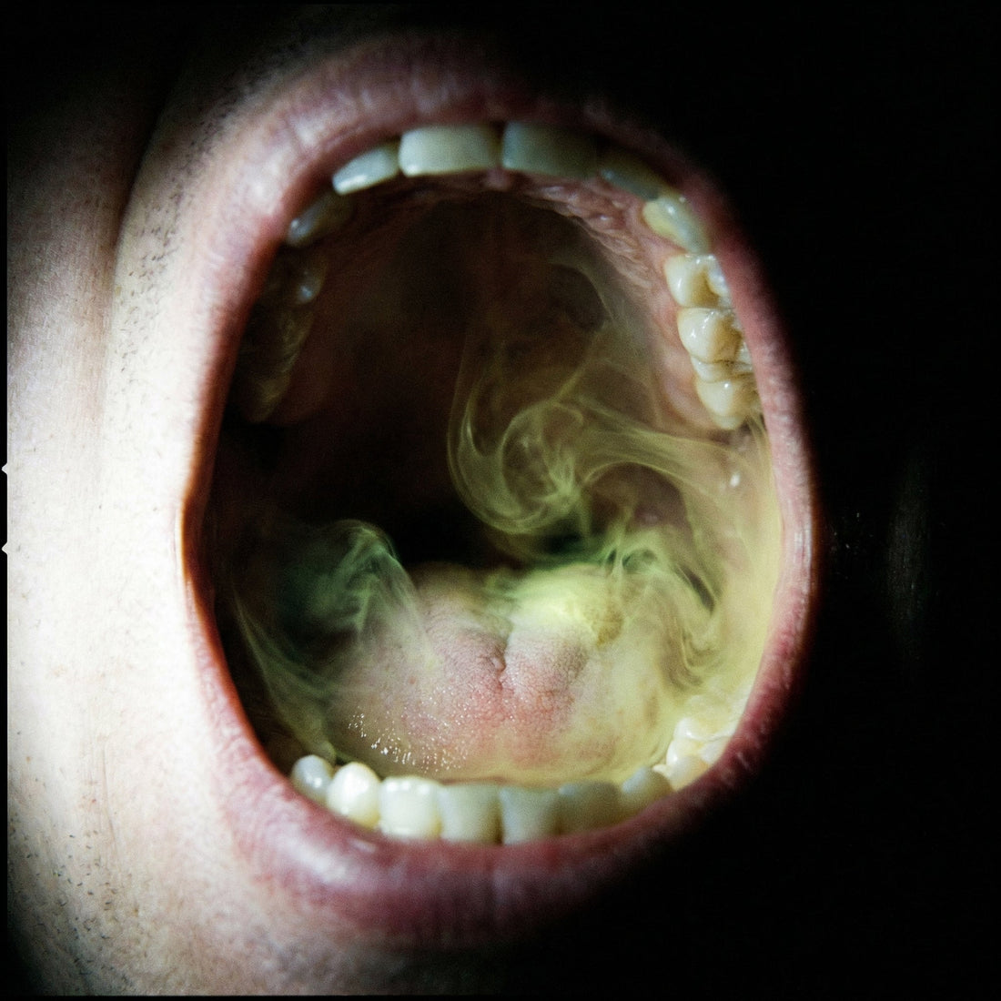 What Causes Bad Breath? The Volatile Sulfur Compounds Nobody Tells You About