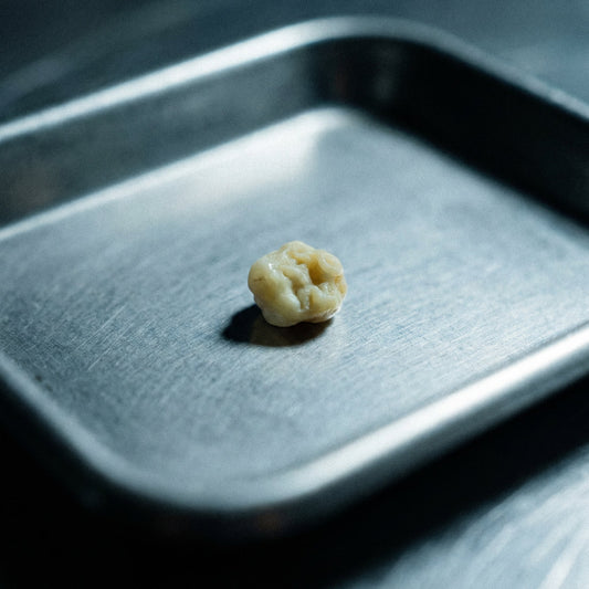 What Are Tonsil Stones? The Hidden Cause of Bad Breath Most People Miss